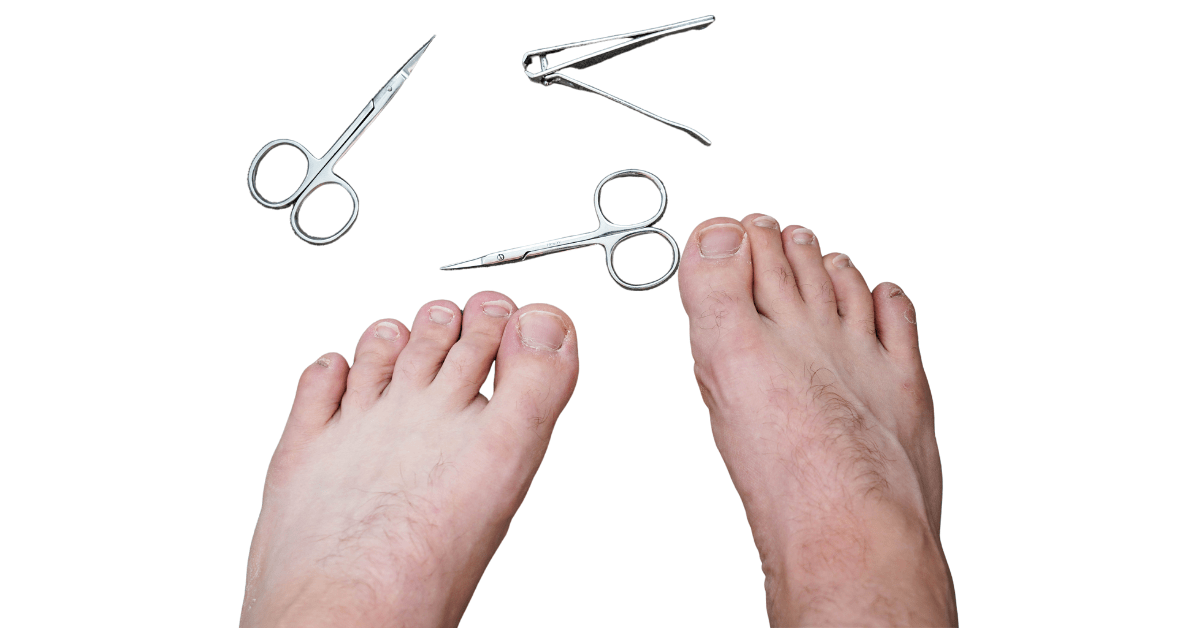 Eingewachsener Nagel