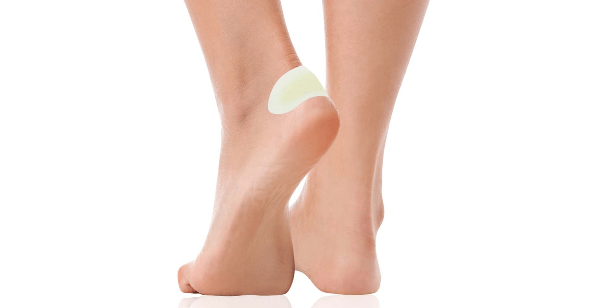 Fußblasen vorbeugen und behandeln